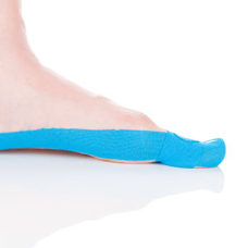Kinesiologisches Taping bei Hallux Valgus | SL Ratgeber