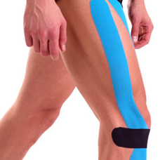 Kinesiologisches Taping des Läuferknies | SL Ratgeber