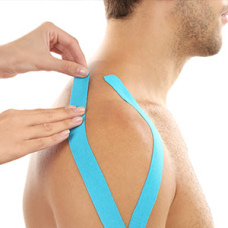 Kinesiologisches Taping der Rotatorenmanschette | SL Ratgeber