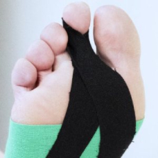 Kinesiologisches Tapen bei Hammerzehen | SL