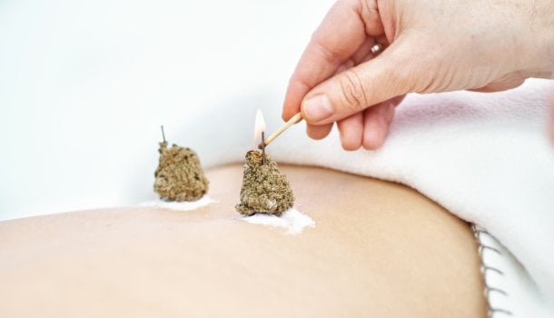 >Direkte Moxibustion
