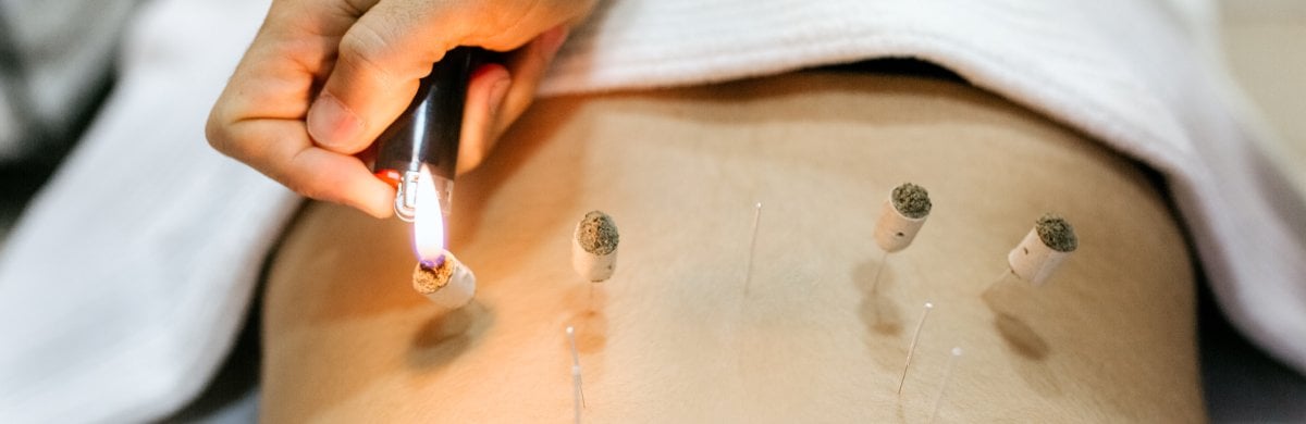 Akupunktur mit Moxibustion