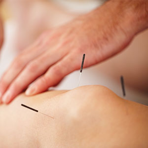 Akupunktur bei Schmerzen der Bänder und Sehnen