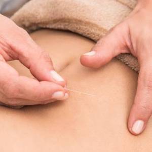 Akupunktur bei Regelschmerzen